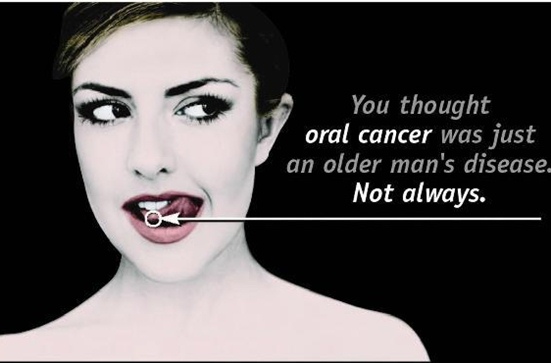 It’s True. You Can Get Throat Cancer From Oral&nbsp;Sex